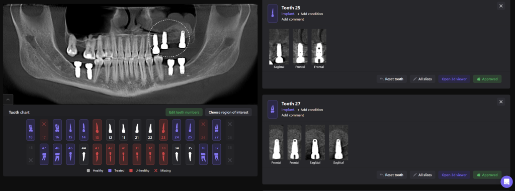Implant planning together with the Diagnocat STL module 10 Implant planning together with the Diagnocat STL module 9