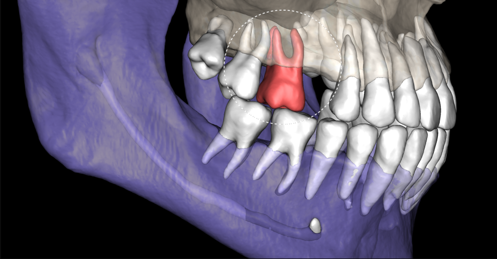 Diagnocat помогает не пропустить первые признаки патологии 2 Diagnocat помогает не пропустить первые признаки патологии 1