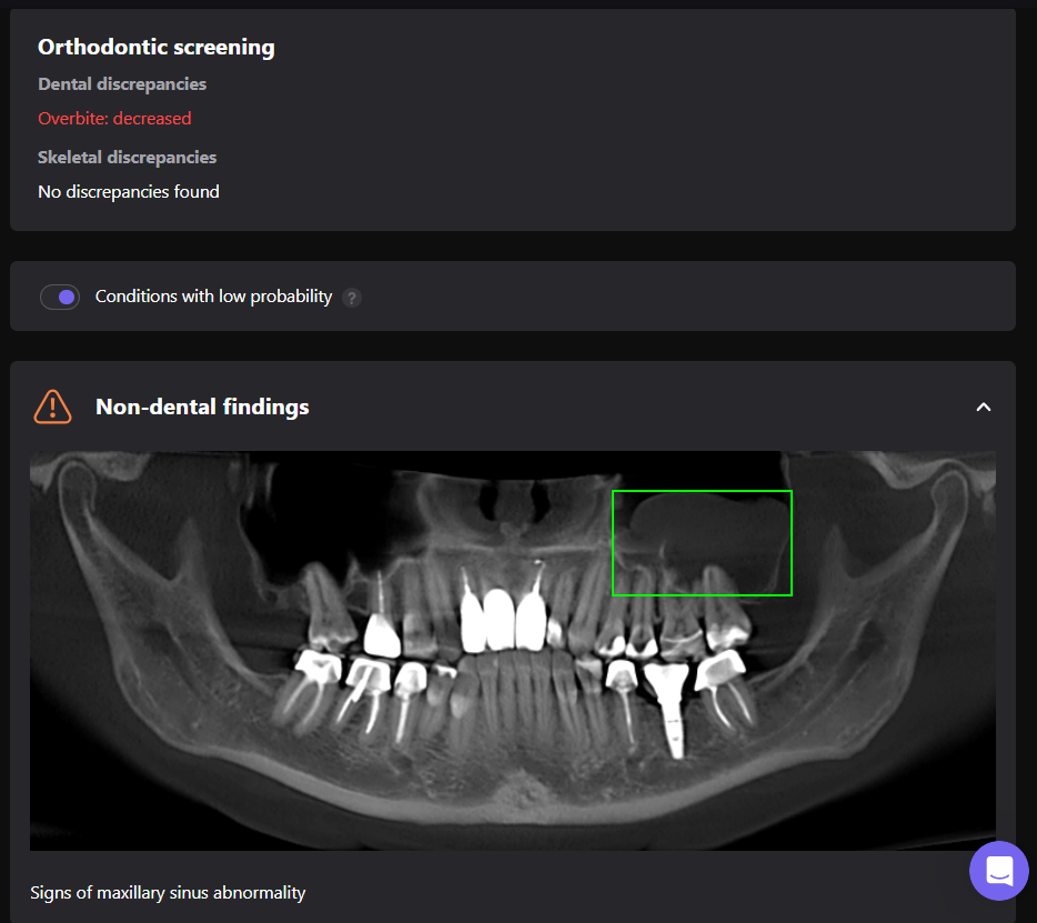 Periodontal disease srceening 4 Periodontal disease srceening 3