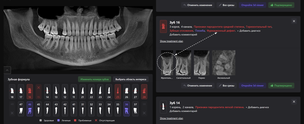 Diagnocat помогает не пропустить первые признаки патологии 4 Diagnocat помогает не пропустить первые признаки патологии 3