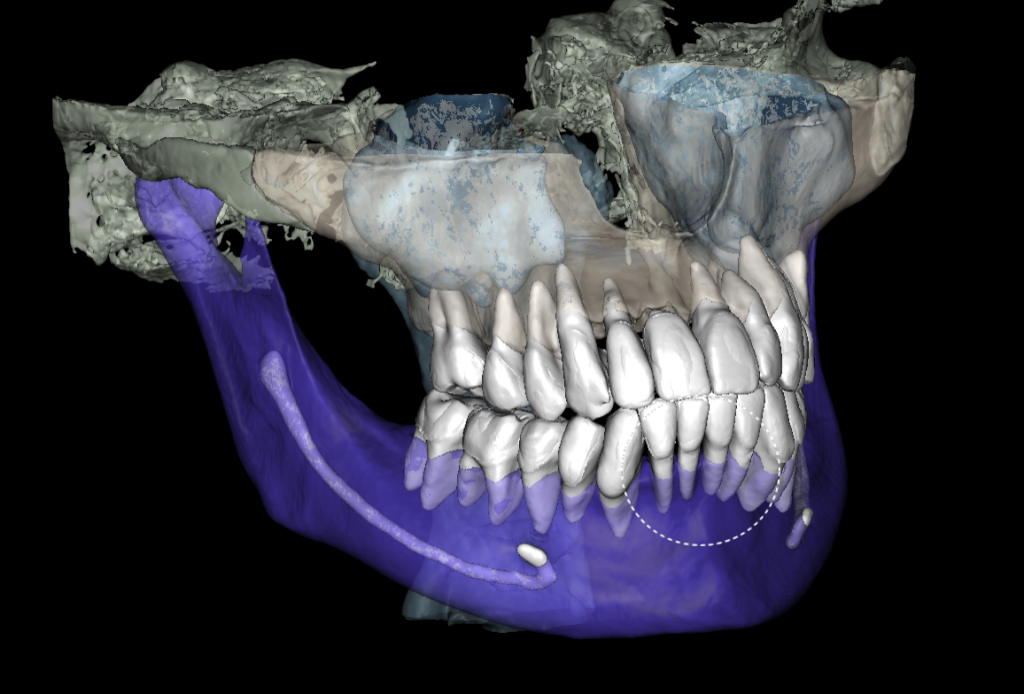 Periodontal disease srceening 6 Periodontal disease srceening 5