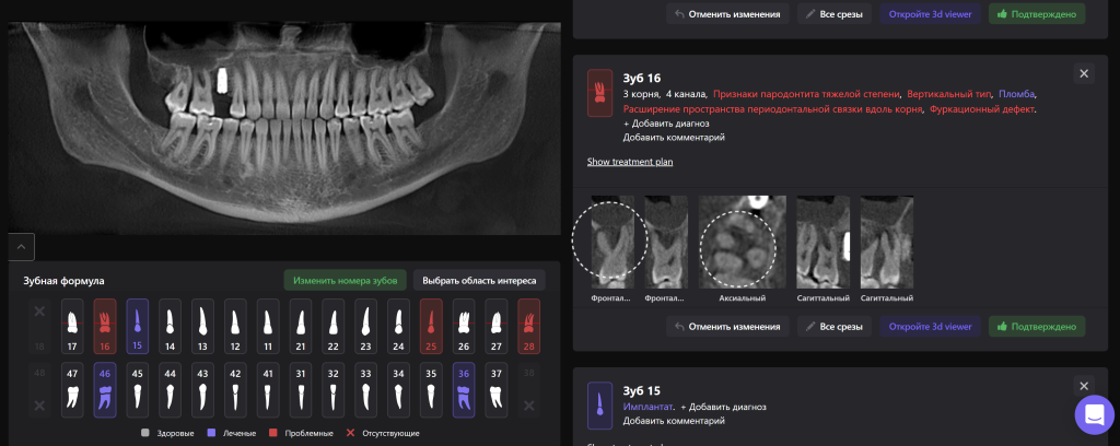 Diagnocat помогает не пропустить первые признаки патологии 6 Diagnocat помогает не пропустить первые признаки патологии 5