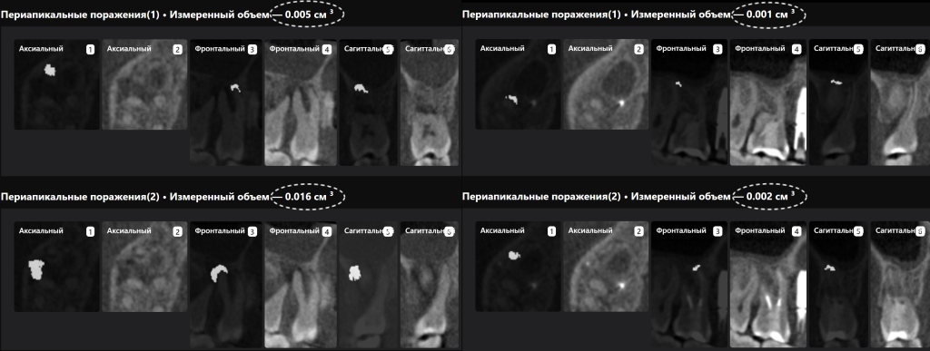 Diagnocat помогает не пропустить первые признаки патологии 8 Diagnocat помогает не пропустить первые признаки патологии 7