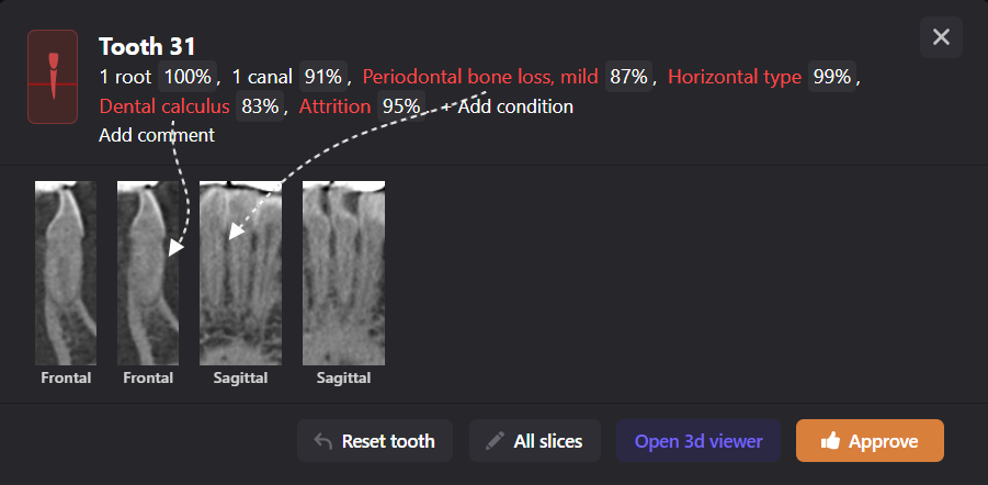Periodontal disease srceening 8 Periodontal disease srceening 7