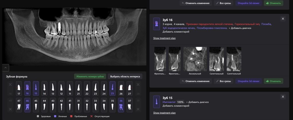 Diagnocat помогает не пропустить первые признаки патологии 10 Diagnocat помогает не пропустить первые признаки патологии 9