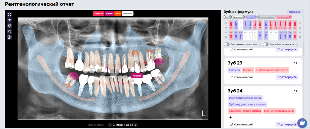 Инновационная функция - «Маски КОТ» 4 Инновационная функция - «Маски КОТ» 3